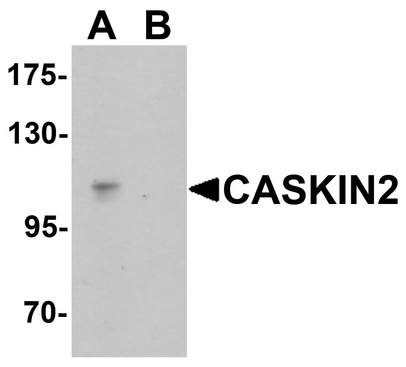 IHC-plus™ Polyclonal Rabbit anti-Human CASKIN2 Antibody (IHC, IF, WB)