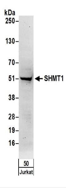 IHC-plus™ Polyclonal Rabbit anti-Human SHMT / SHMT1 Antibody (aa453-483, IHC, WB)