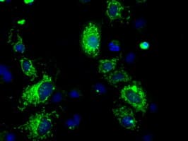 ATP5B / ATP Synthase Beta Antibody (clone OTI7F4)