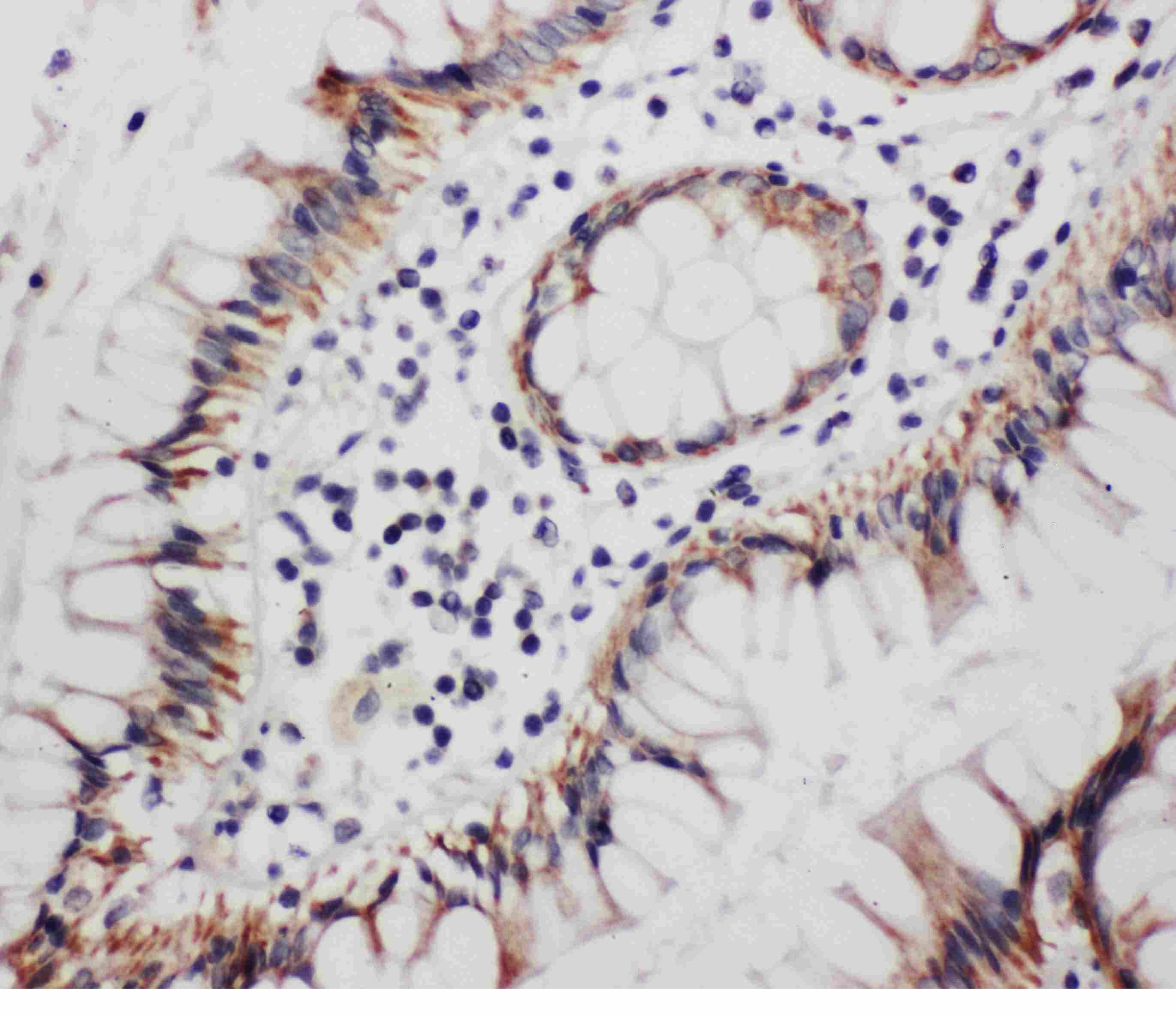 PR / Progesterone Receptor Antibody (aa536-553)