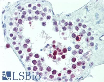 PathPlus™ SMN1 Antibody (aa50-100)