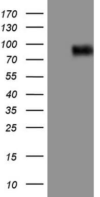 CFI / Complement Factor I Antibody (aa340-583, clone OTI2D4, Carrier-free)