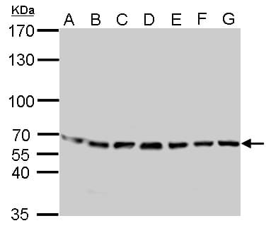 STI1 / STIP1 Antibody (aa1-300)