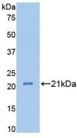 FBLN1 / Fibulin 1 Antibody (aa347-521)