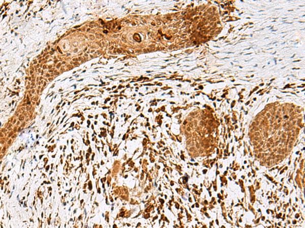 Polyclonal Rabbit anti-Human SCRN2 / Ses2 Antibody (IHC, WB)