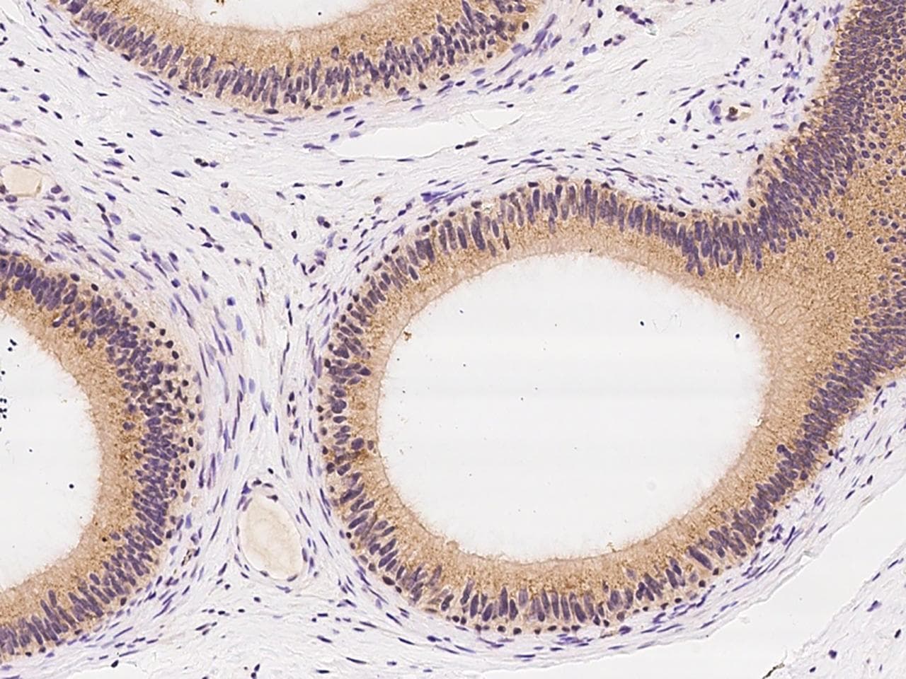 Polyclonal Rabbit anti-Human ZC3H12C Antibody (IHC)