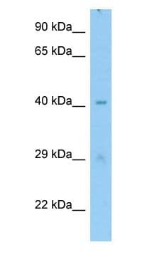 MTERF4 / MTERFD2 Antibody (aa268-317)