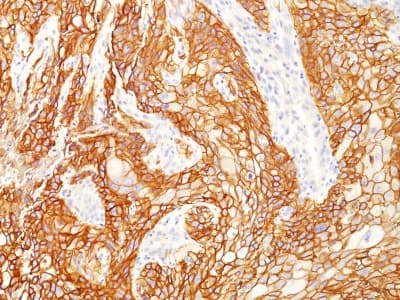 EGFR Antibody (clone GFR/2600R, Azide-free, Carrier-free)