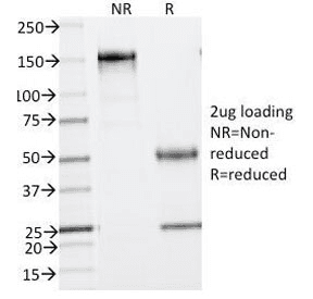 Phosphotyrosine Antibody (clone SPM102)