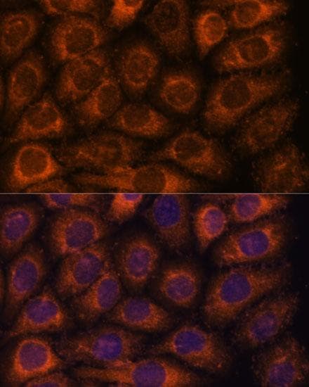 Polyclonal Rabbit anti-Human CCT6B Antibody (IF)