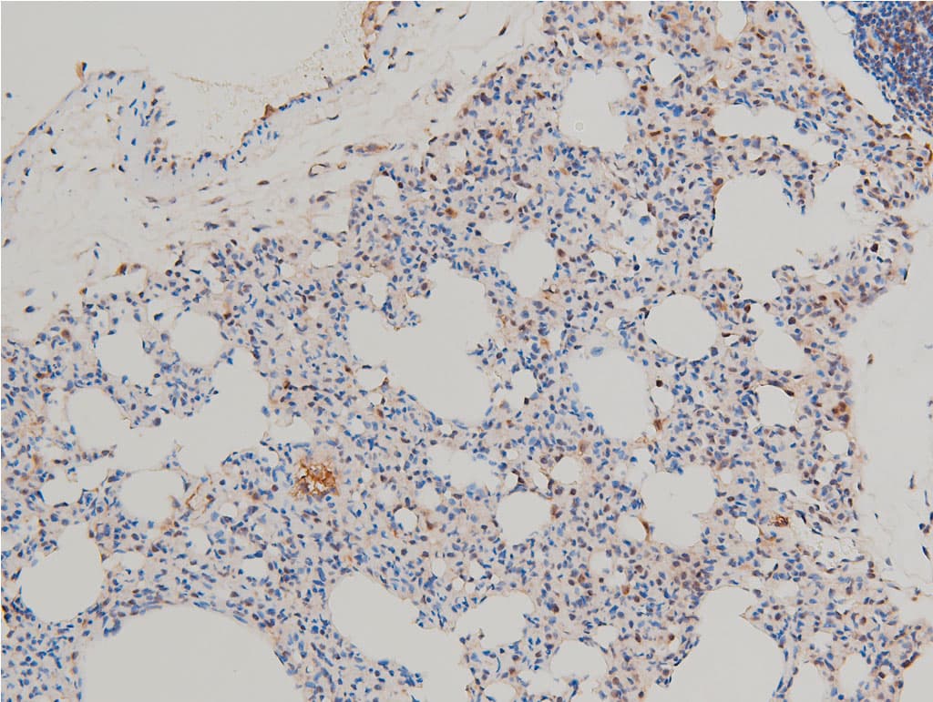 LIMK1 / LIMK Antibody (phospho-Thr508)