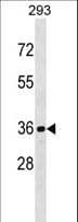 CDKL1 Antibody (aa285-316)