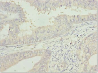 ZFAND3 / TEX27 Antibody