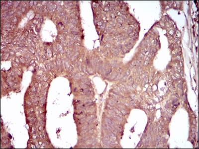 C1qRP / CD93 Antibody (aa474-535, clone 2F7D11)