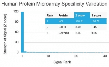 VCL / Vinculin Antibody (clone VCL/2573)