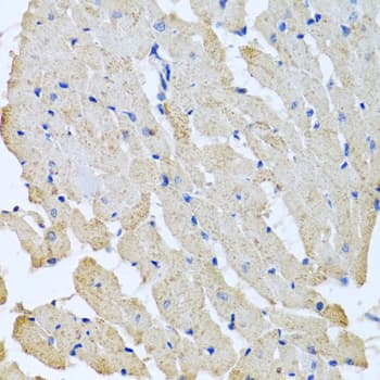 GPLD1 / GPIPLD Antibody