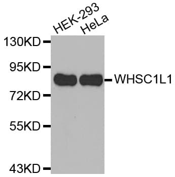 IHC-plus™ NSD3 / WHSC1L1 Antibody