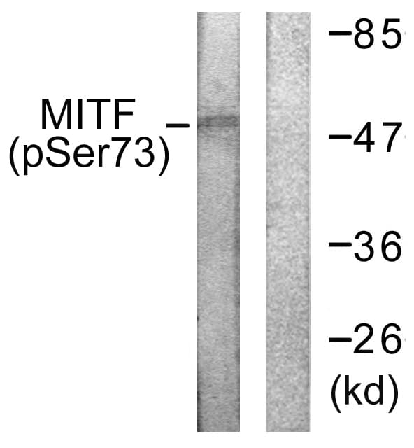 Polyclonal Rabbit anti-Human MITF Antibody (phospho-Ser180/Ser73, WB)
