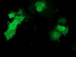 Monoclonal Mouse anti-Human KCTD14 Antibody (clone OTI2A6, IHC, IF, WB)