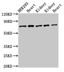SLC25A12 / ARALAR Antibody