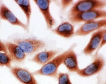 Polyclonal Rabbit anti-Human CAPN1 / Calpain 1 Antibody (aa313-327, IHC, WB)