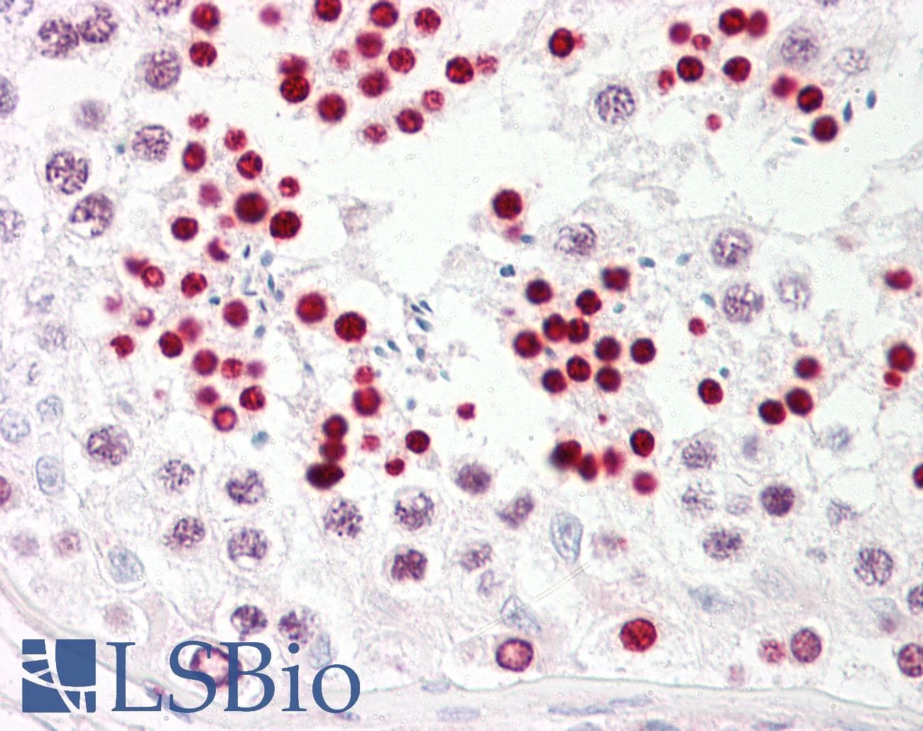 IHC-plus™ Polyclonal Rabbit anti-Human TP53 / p53 Antibody (aa344-393, IHC, IF, WB)