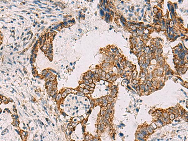 PDHA1 / PDH E1 Alpha Antibody