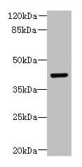 DCX / Doublecortin Antibody