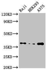 Polyclonal Rabbit anti-Human PPP1CB Antibody (IHC, WB)