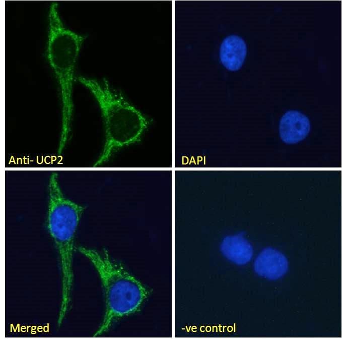 IHC-plus™ Polyclonal Goat anti-Human UCP2 Antibody (aa101-113, IHC, IF, WB)