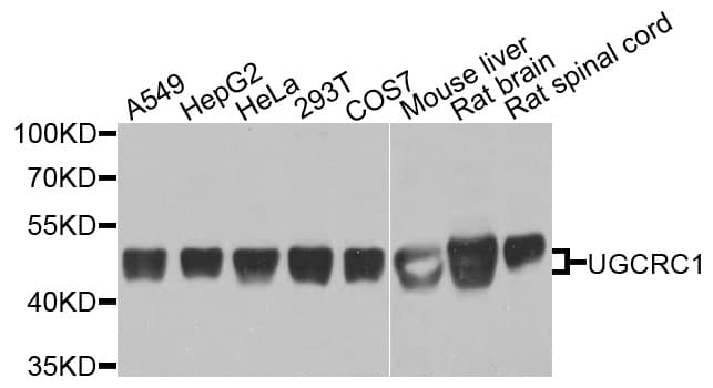 Polyclonal Rabbit anti-Human UQCRC1 Antibody (IHC, WB)