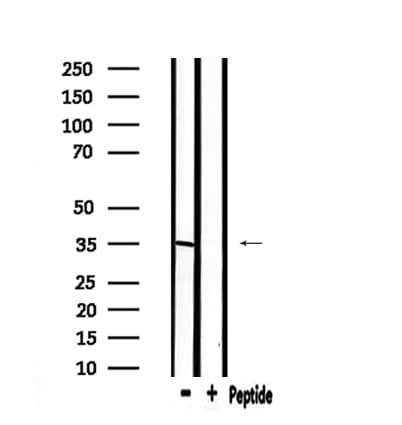 Polyclonal Rabbit anti-Human ELOVL6 Antibody (IF, WB)