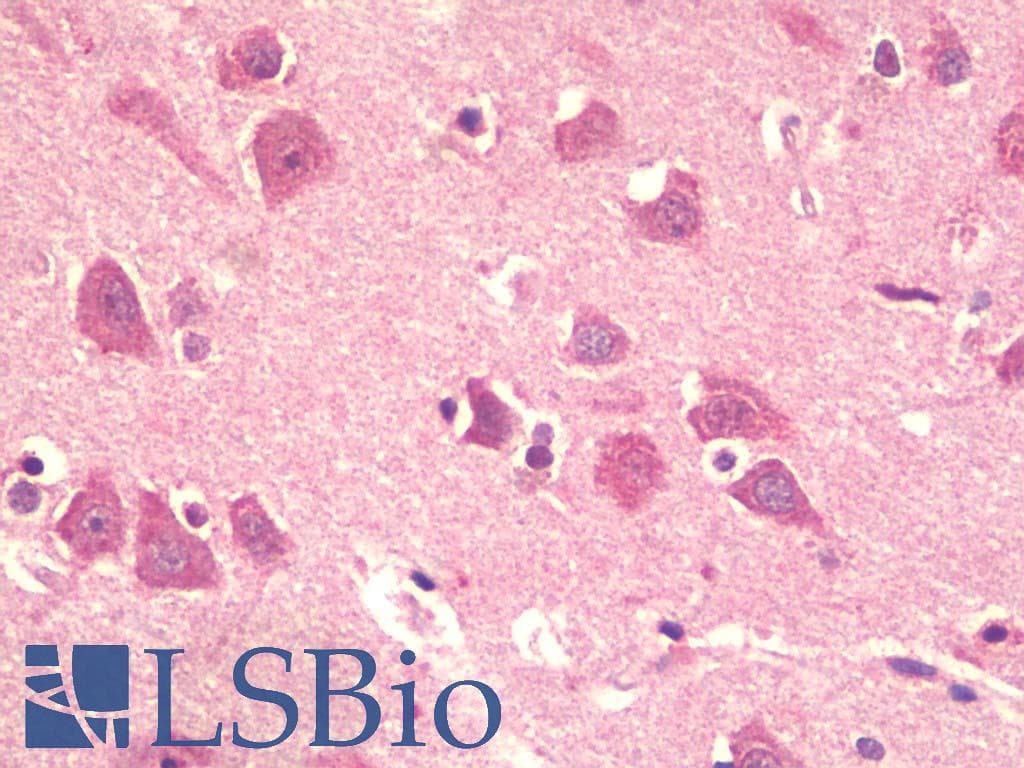 IHC-plus™ KPNA5 Antibody