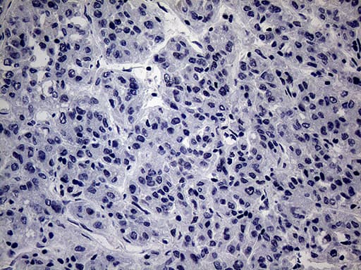 Monoclonal Mouse anti-Human WTAP Antibody (clone OTI6C3, aa2-106, IHC, WB)