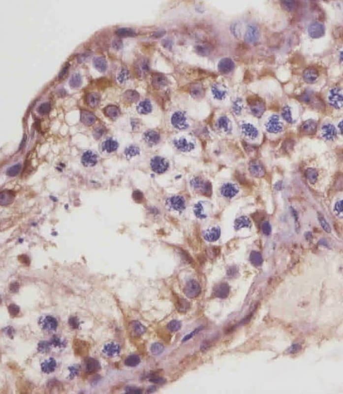 Betaglycan / TGFBR3 Antibody (N-Terminus)