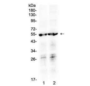 Polyclonal Rabbit anti-Human PTGER4 / EP4 Antibody (WB)
