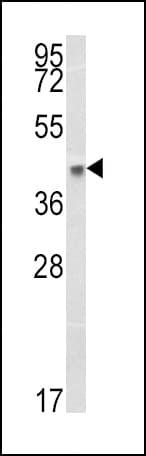 HLA-B Antibody (aa62-90)