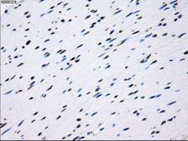 Monoclonal Mouse anti-Human L1CAM Antibody (clone OTI4F4, IHC, IF, WB)
