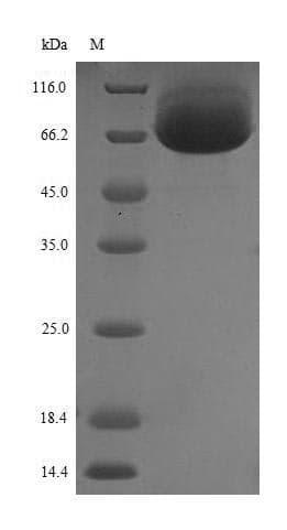 Human DPYSL5 / CRMP5 Protein (Recombinant 10His, N-terminus + Myc, C-terminus)