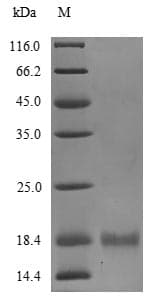 Bordetella bronchiseptica BB3856 Protein (Recombinant 10His, N-terminus + Myc, C-terminus)