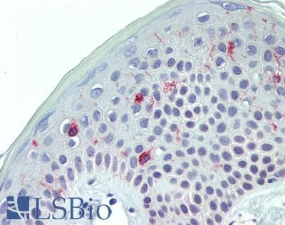 IHC-plus™ CD207 / Langerin Antibody