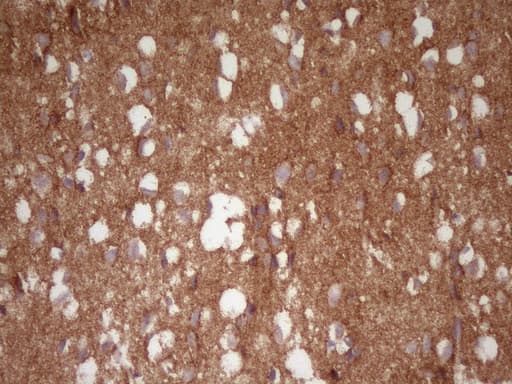 Monoclonal Mouse anti-Human NCAM / CD56 Antibody (clone UMAB192, aa20-718, IHC, WB)