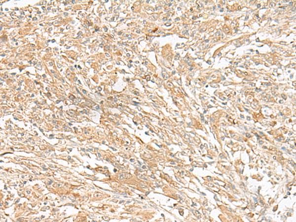 GIPC1 / GIPC Antibody