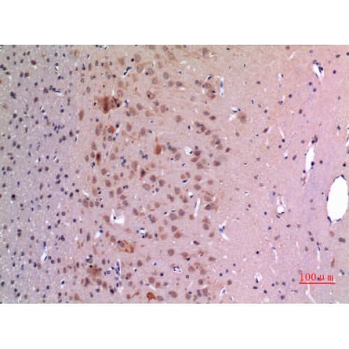 GDF5 / GDF-5 Antibody (351-400 aa, Internal)