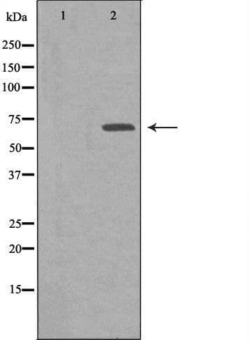 IGF2BP2 Antibody