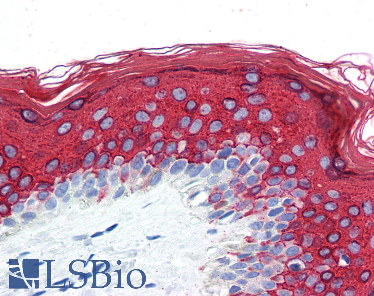 IHC-plus™ KRT10 / CK10 / Cytokeratin 10 Antibody (clone AE20)