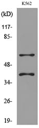 IL2RG / CD132 Antibody
