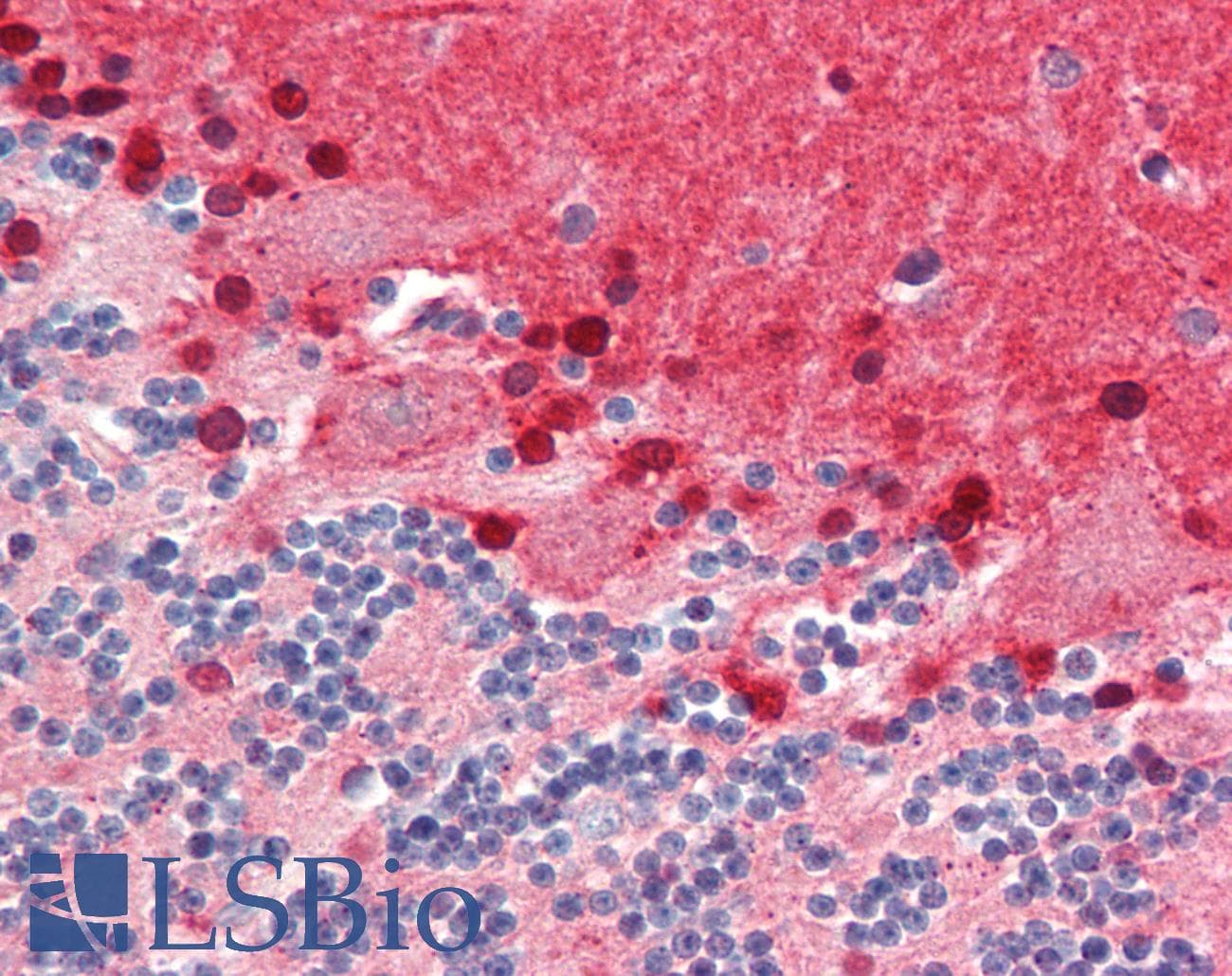 IHC-plus™ Polyclonal Rabbit anti-Human SEPT7 / Septin 7 Antibody (aa75-125, IHC, WB)