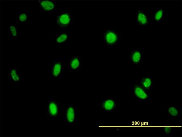 Monoclonal Mouse anti-Human MPG Antibody (clone 2C5, IHC, IF, WB)