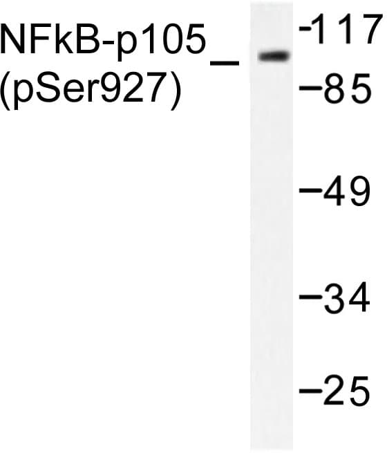 NFKB1 / NF-Kappa-B Antibody (phospho-Ser927)